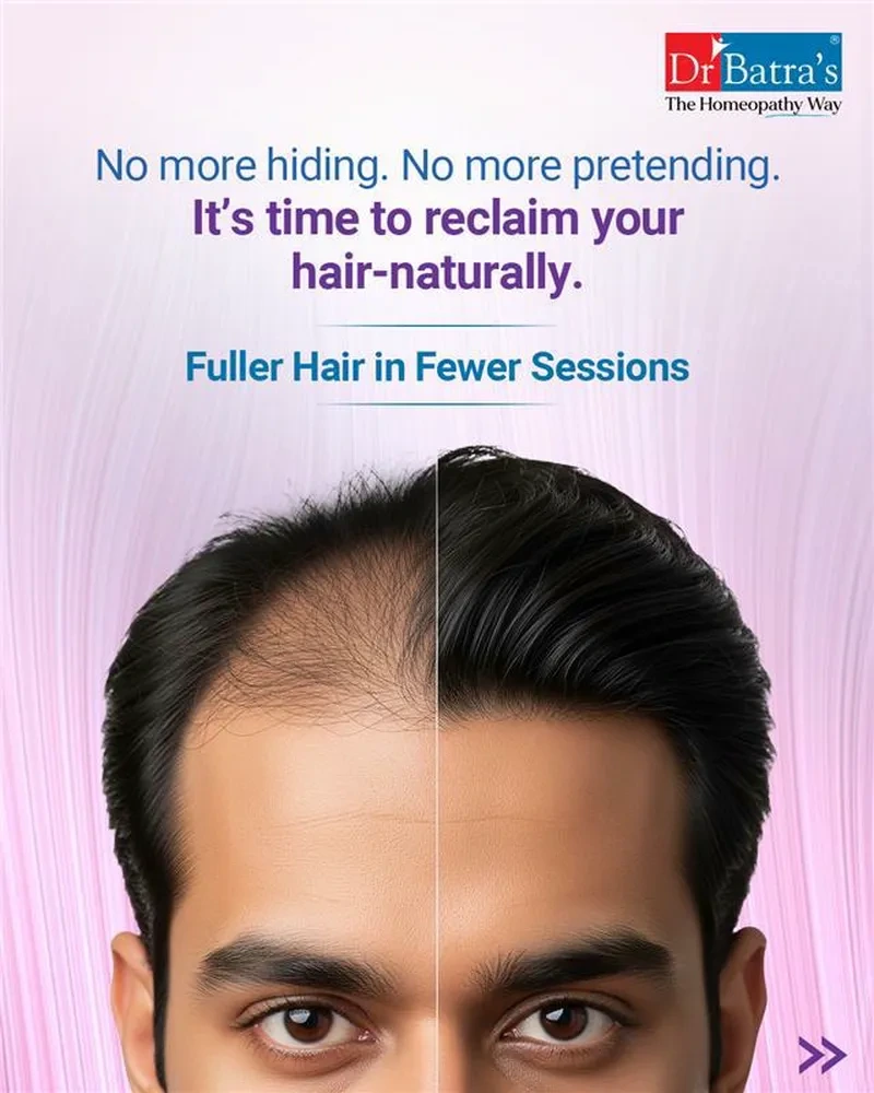 Xogen Advance Hair Therapy, Dr Batra's, Chhattisgarh